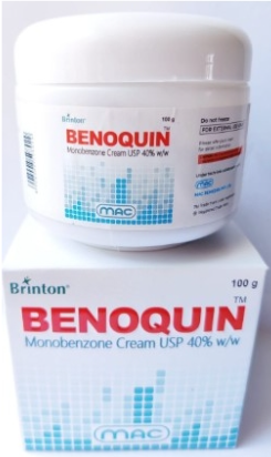백반증 고농도 모노벤존 크림 베노퀸 BENOQUIN CREAM 40%